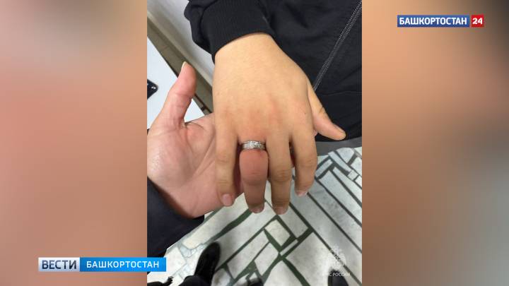 В Башкортостане спасатели помогли снять кольцо с пальца подростка | ГТРК «Башкортостан»